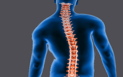 Problèmes de dos : comment traiter la scoliose?