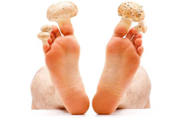 Champignon dans l’ongle du pied