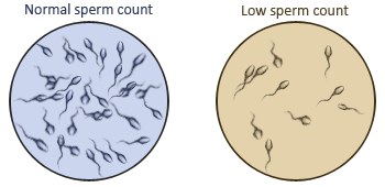 BabyStart Fertilcount Comptage sperme