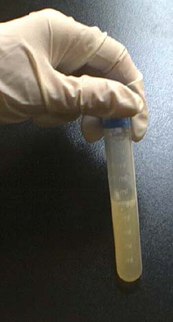 tubo de ensayo de esperma