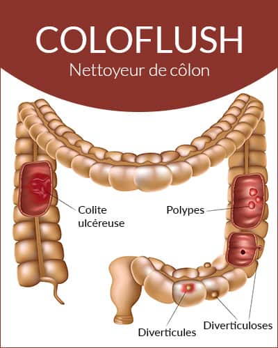 Native Remedies Coloflush nettoyeur colon