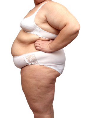 Femme obese graisse