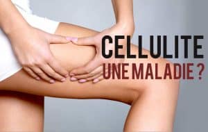 Cellulite – eine hässliche Krankheit, die keine ist!